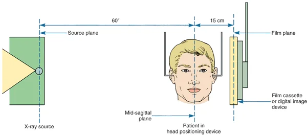 The standard American positioning for a cephalometric radiograph. In Europe the patient faces the other way, and the x-ray source is further from the patient.