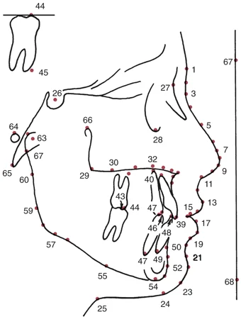 A typical set of landmark points to be digitized in creating a virtual ceph tracing.