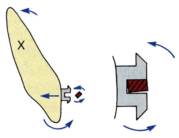 A rectangular wire that fits tightly within a rectangular bracket slot can produce facio-lingual root movement (torque).