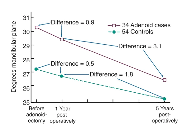 This graph shows a decrease in mandibular plane angle of children who underwent adenoidectomy.