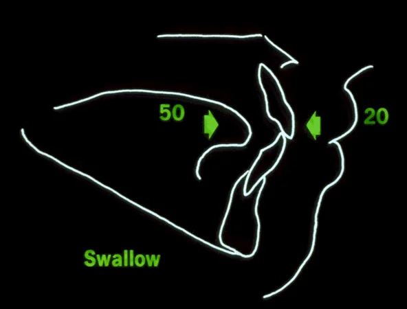 Tongue and lip pressures during swallowing.