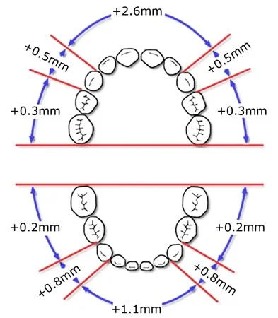 Average primary spacing: More spacing is present in the maxillary than mandibular arch.