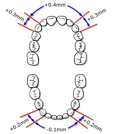 Incisor liability in the mandibular arch: Crowding is likely in the lower arch because of the incisor liability.