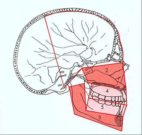 Components of the face: the goal of cephalometric analysis is to evaluate their relationships in the a-p and vertical planes.