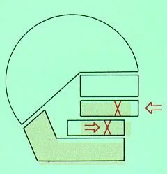 Class II camouflage is based on retracting the upper incisors. If extractions are done in the lower arch, the space must be closed without retracting the lower incisors.