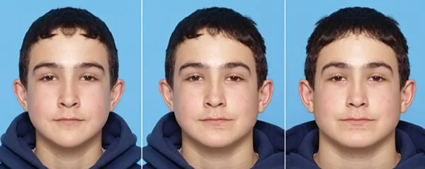 Real image in center; on the left, two left sides as mirror image; on the right, two right sides. Note that for this boy as for most people, the right side of the face is larger.