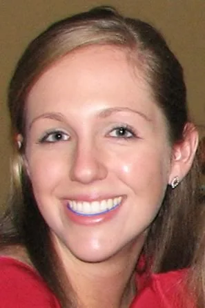 An ideal smile arc, with the curvature of the arc of the maxillary incisors matching the curvature of the lower lip on smile.