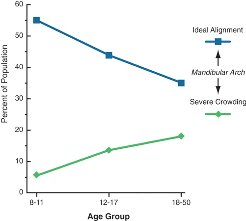 Changes in mandibular incisor alignment over time: Over time, lower incisor crowding often develops in individuals whose teeth were well-aligned, and gets worse in those who already had crowding.