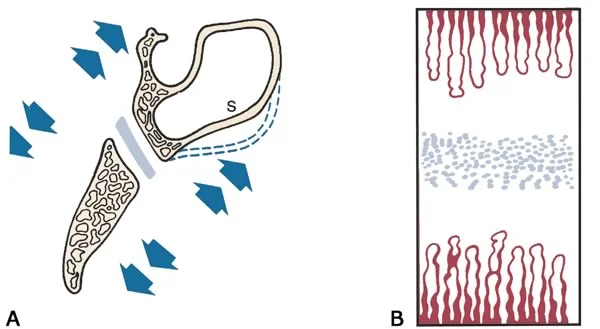 A: distant view of the spheno-occipital synchondrosis, where growth pushes the sphenoid bone away from the occipital bone. B: close-up view of a synchondrosis, showing the proliferating cartilage in the center.