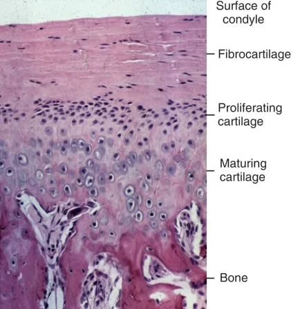 Endochondral ossification of the mandibular condyle.