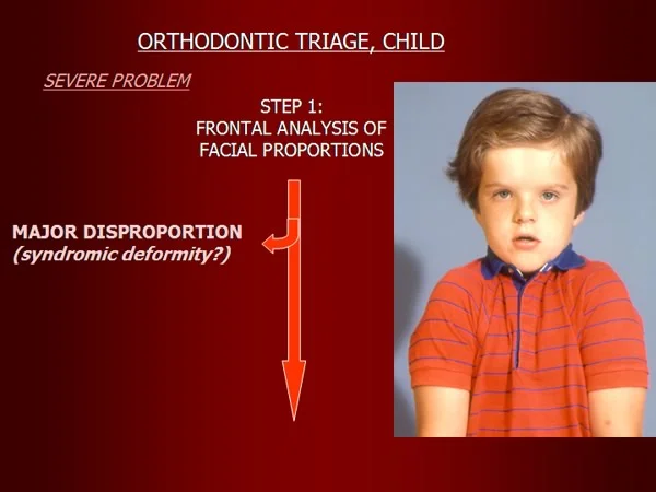 Orthodontic triage step 1: syndrome present?