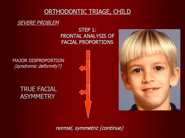 Orthodontic triage step 1: facial asymmetry?
