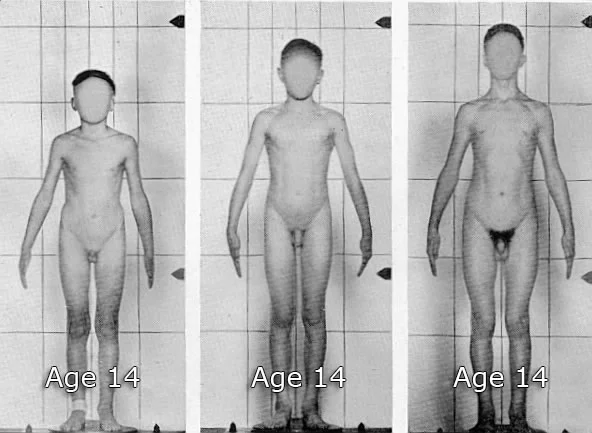 3 Ectomorphs: These boys will mature later and be taller than their more muscular counterparts.