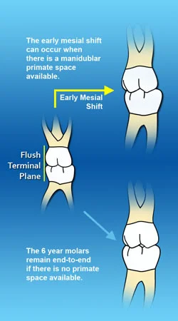 Early mesial shift: The mandibular primate space is used in the early mesial shift.
