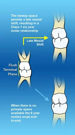 Late mesial shift: The leeway space is used during the late mesial shift.