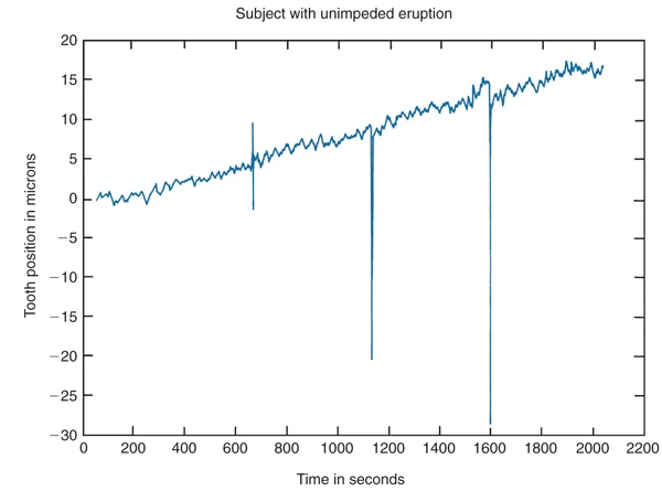 Plot of tooth position over time: Intermittent force (the spikes downward) does little to inhibit steady movement over time.
