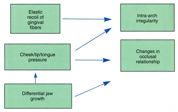 The major causes of relapse after orthodontic treatment. Gingival fibers and pressure from cheeks / lips / tongue that affect alignment are major problems in the first post-treatment months, and unfavorable growth is the major contributor to long-term changes in occlusion.