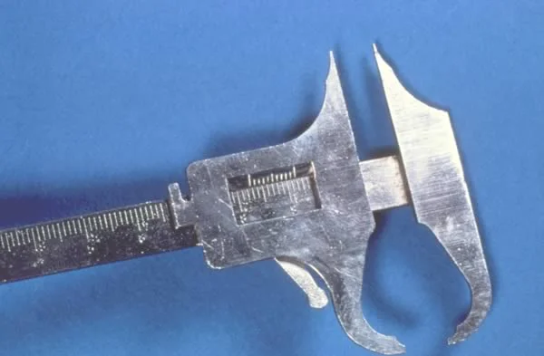Boley gauge with sharpened tips: Digital calipers also can be used for measurement of tooth width. They are more precise but also need thin, not thick, tips to be accurate for tooth measurements.