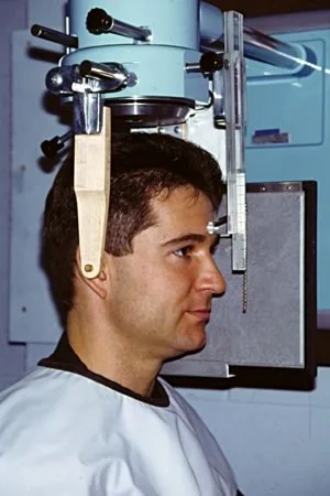 The head-holder for obtaining cephalometric radiographs, which is necessary to obtain longitudinal records that can be compared accurately.