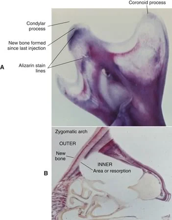 Vital Staining of (A) mandible and (B) zygomatic arch: Bands of alizarin staining in this preparation of the ramus of the mandible (A) indicate where bone was forming at the time of the injection. Note the white unstained bone at the tip of the coronoid and condylar processes. This is bone that was formed in the last 2 weeks, after the final injection.