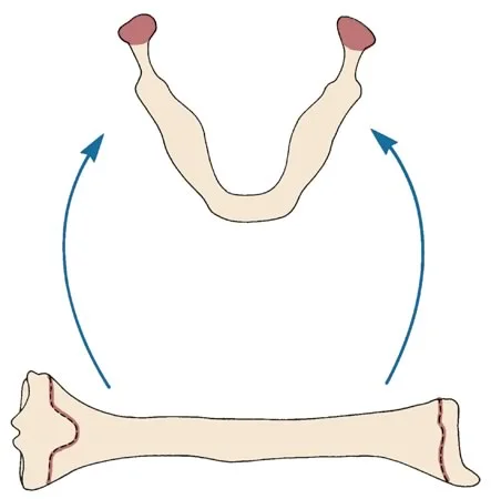 The mandible seen as a long bone bent into a horse shoe shape: If the condylar cartilage of the mandible functioned like the epiphyseal cartilage of a long bone, it would be a growth center and drive mandibular growth.