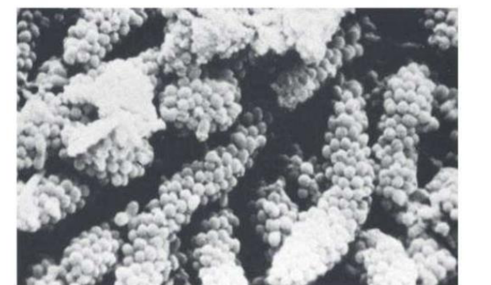 Fig. 10.11 Long-standing supragingival plaque near the gingival margin demonstrating a “corn cob” arrangement. A central gram-negative filamentous core supports the outer coccal cells, which are firmly attached by inter-bacterial adherence or coaggregation.