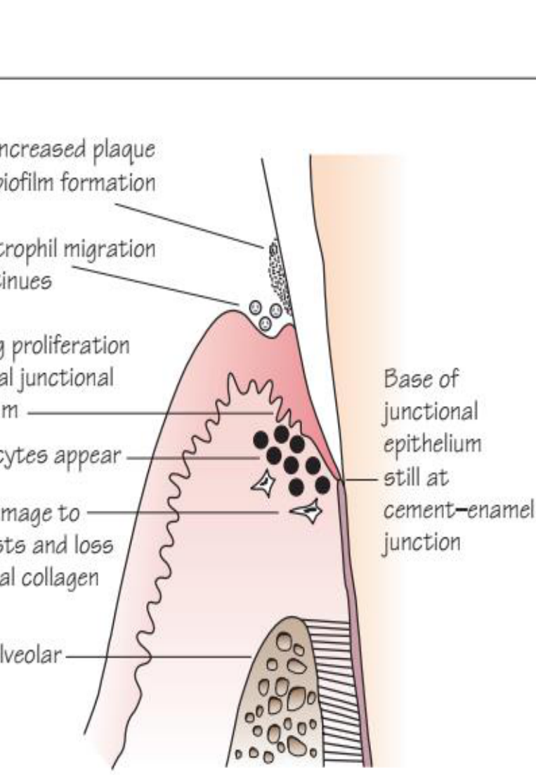 Figure 8.4 An early lesion.