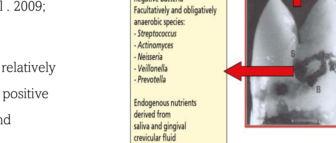 Fig. 8-2 Predominant groups of bacteria found at, and the key features of, distinct sites on the tooth surface.