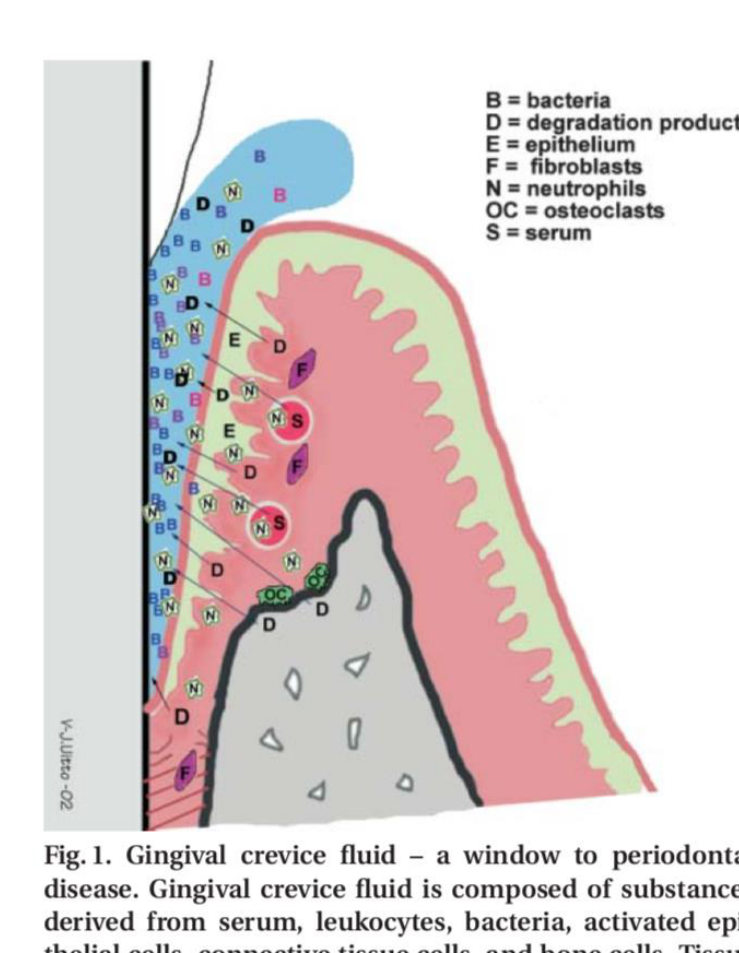 Fig. 1. Gingival crevice fluid – a window to periodontal disease. Gingival crevice fluid is composed of substances derived from serum, leukocytes, bacteria, activated epithelial cells, connective tissue cells, and bone cells. Tissue destruction during periodontal inflammation results in production of tissue fragments and growth factors released from tissue stores. All these substances reflect the periodontal disease process and can be potentially used as indicators of periodontal condition.