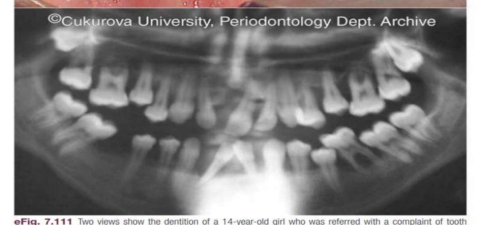 ©Cukurova University, Periodontology Dept. Archive