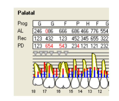Palatal