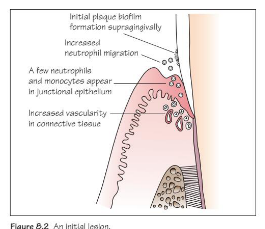 Figure 8.2 An initial lesion.