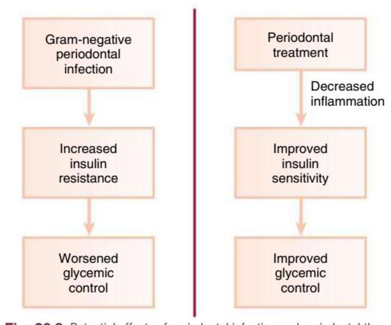 Fig. 26.8 Potential effects of periodontal infection and periodontal therapy on glycemia in patients with diabetes.