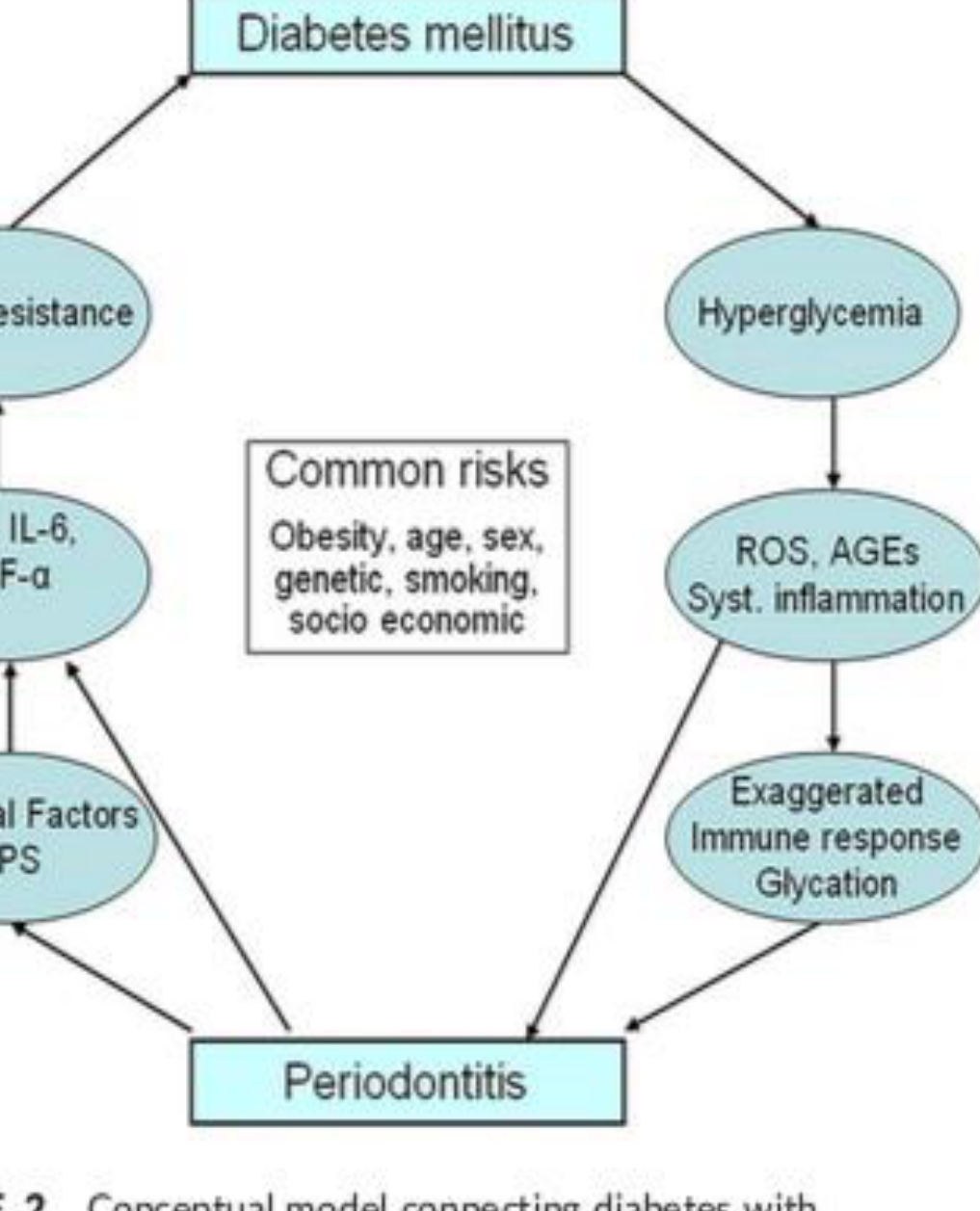 FIGURE 2 Conceptual model connecting diabetes with periodontitis, and showing possible pathogenic factors and risk factors. AGEs, advanced glycation end-products; IL, interleukin; LPS, lipopolysaccharides; ROS, reactive oxygen species; TNF-α, tumor necrosis factor-alpha