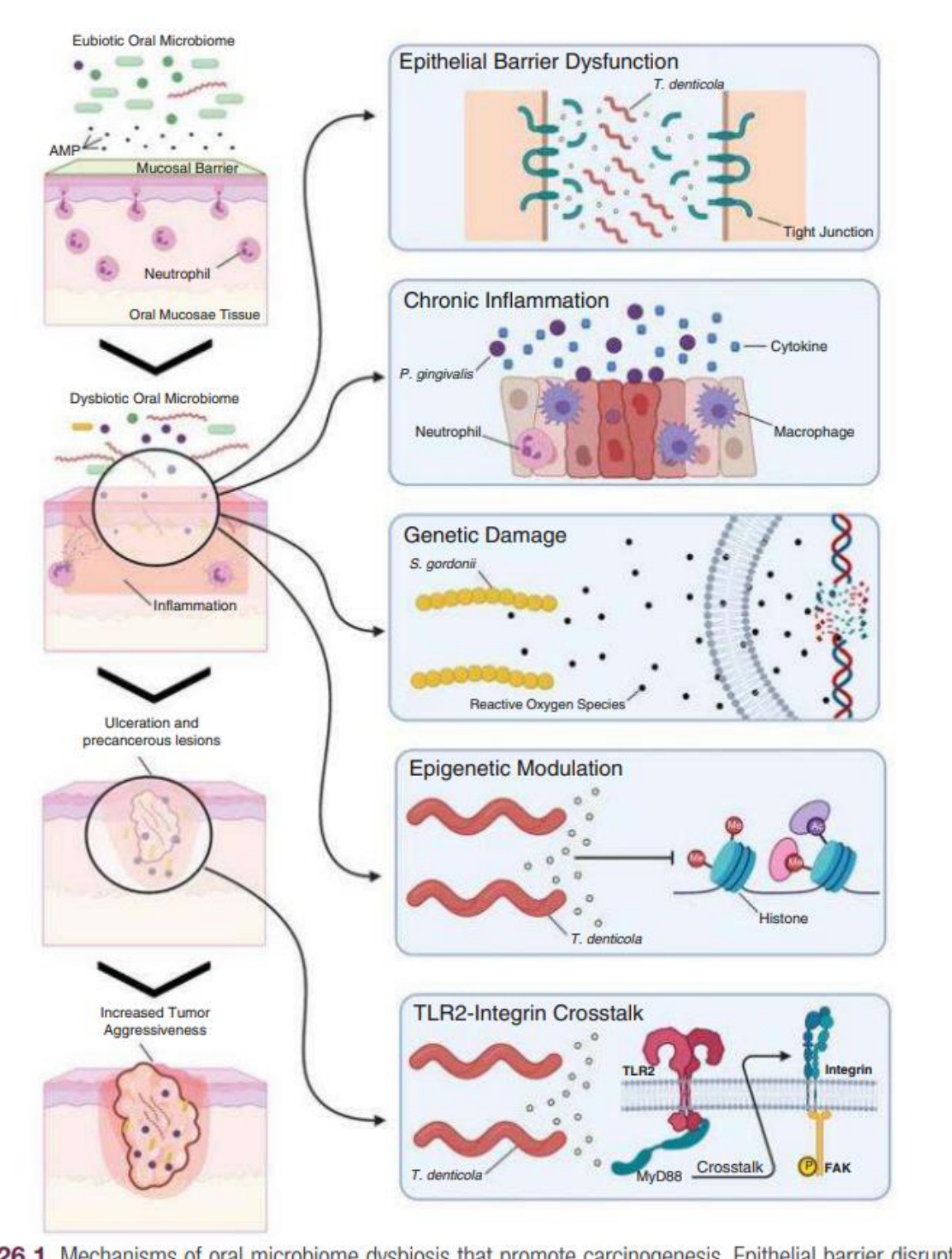 Fig. 26.1 Mechanisms of oral microbiome dysbiosis that promote carcinogenesis. Epithelial barrier disruption, bacterial invasion, chronic inflammation, genetic and epigenetic modulation, and altered tumor cell migration and signaling are mechanisms by which an oral microbiome dysbiosis can promote carcinogenesis.