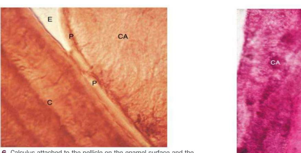 Fig. 24.6 Calculus attached to the pellicle on the enamel surface and the cementum. An enamel void (E) has been created during the preparation of the specimen. C, Cementum; CA, calculus; P, pellicle. (Courtesy Dr. Erwin Schaffer, Minneapolis, MN.)