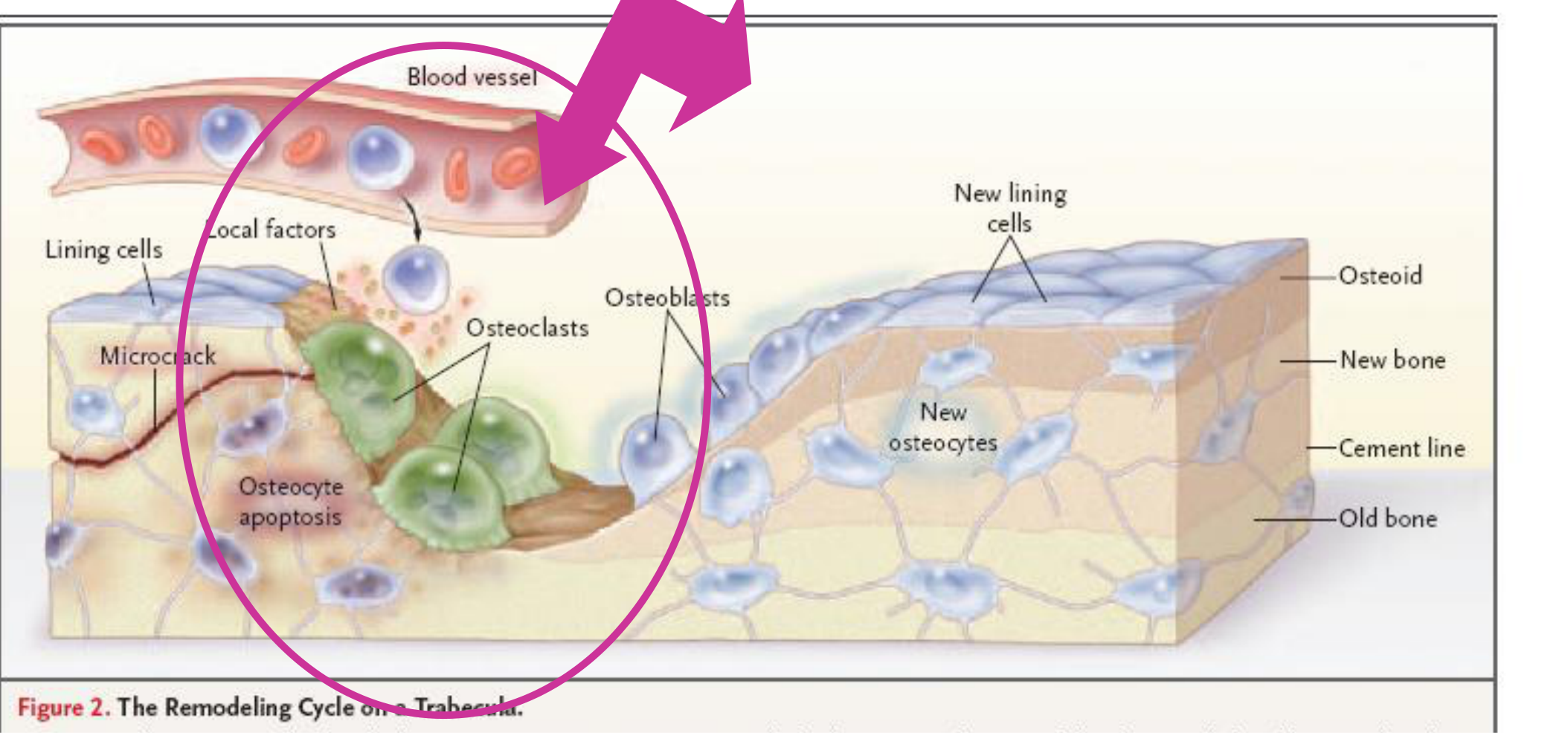 Figure 2. The Remodeling Cycle on a Trabecula.