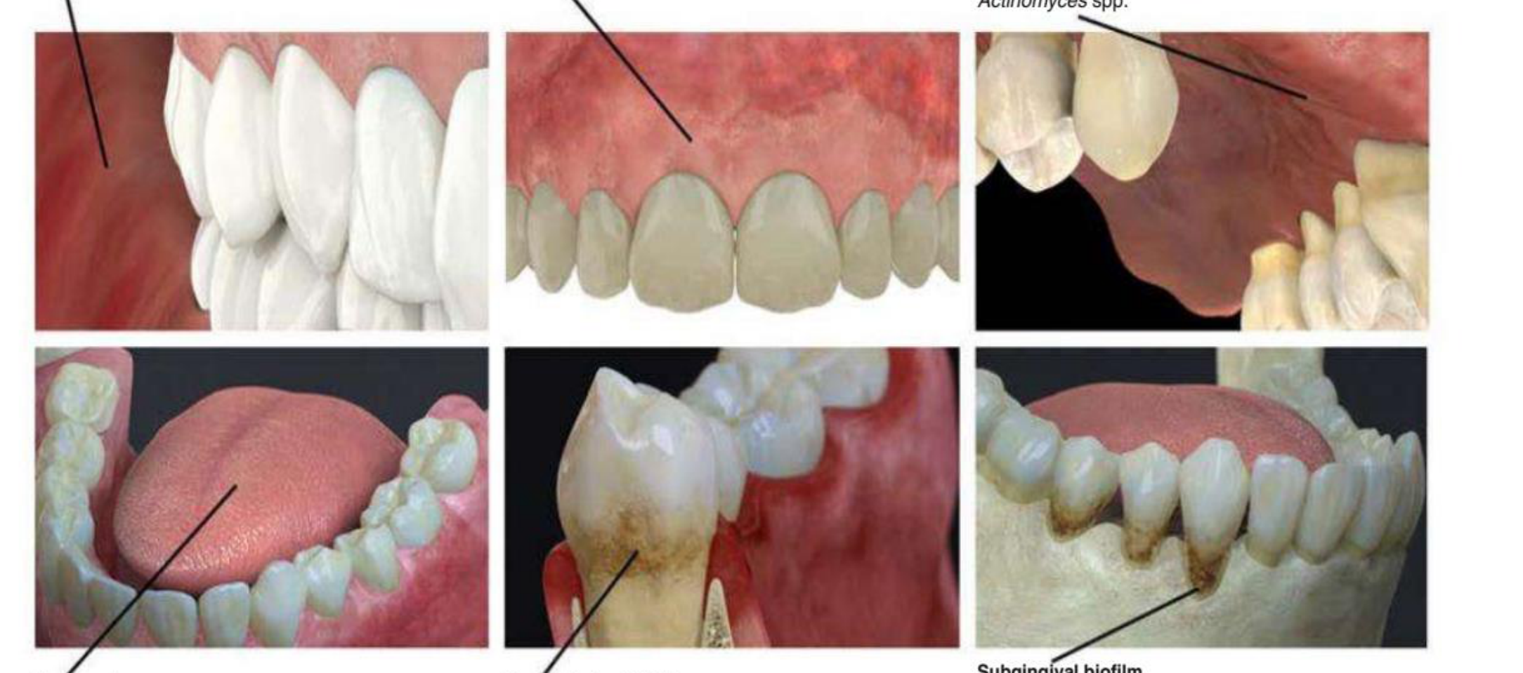 Fig. 10.1 Different intra-oral ecological niches with the most prevalent bacterial species.