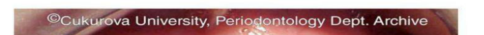 ©Cukurova University, Periodontology Dept. Archive