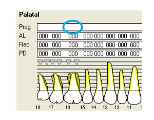 Palatal