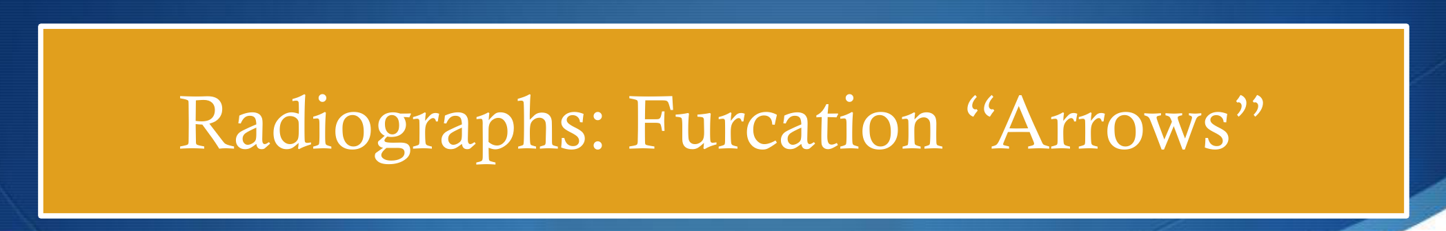 Radiographs: Furcation 'Arrows'
