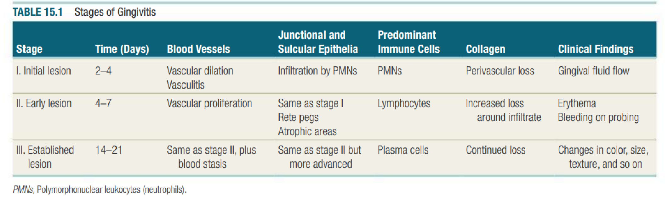 TABLE 15.1 Stages of Gingivitis