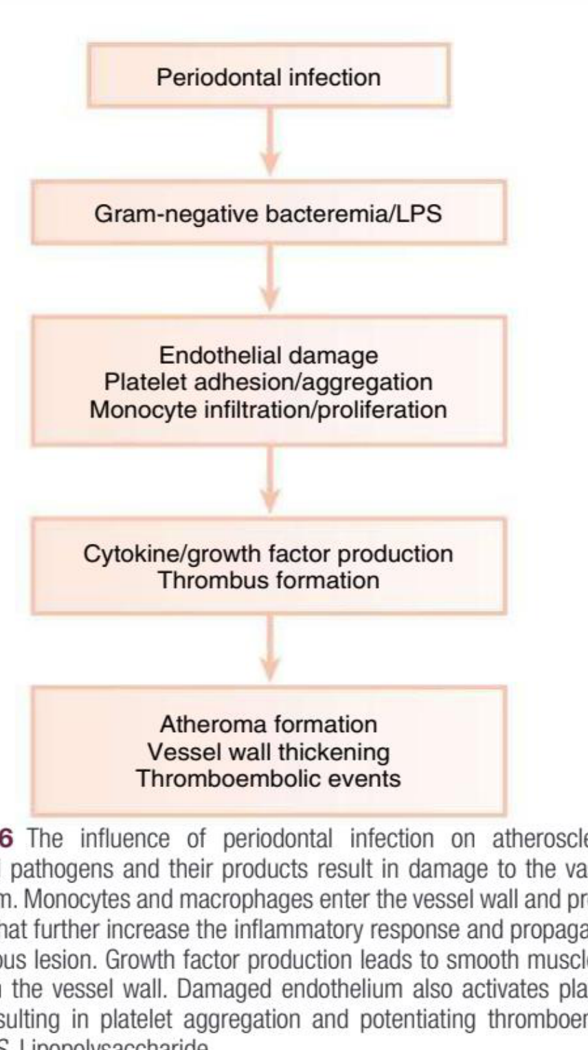 Fig. 26.6 The influence of periodontal infection on atherosclerosis.