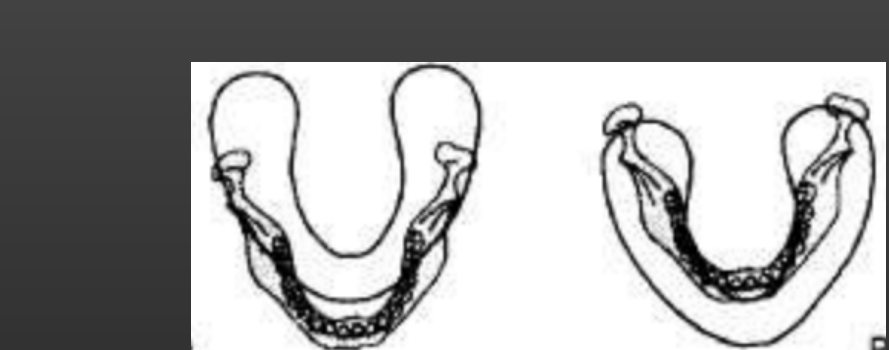 Note the posterior teeth are still within the focal trough