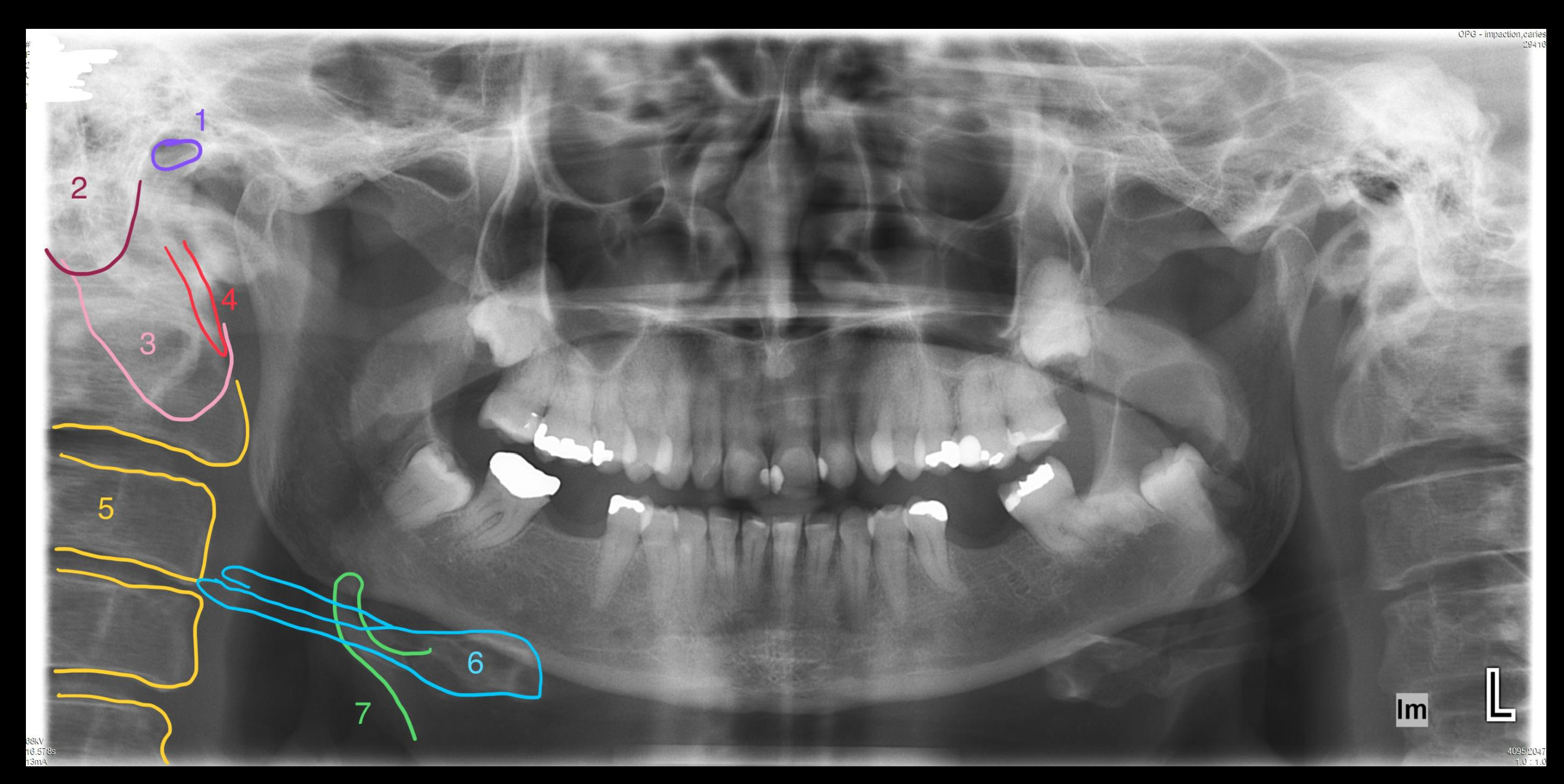 Case 6 – Peripheral Structures