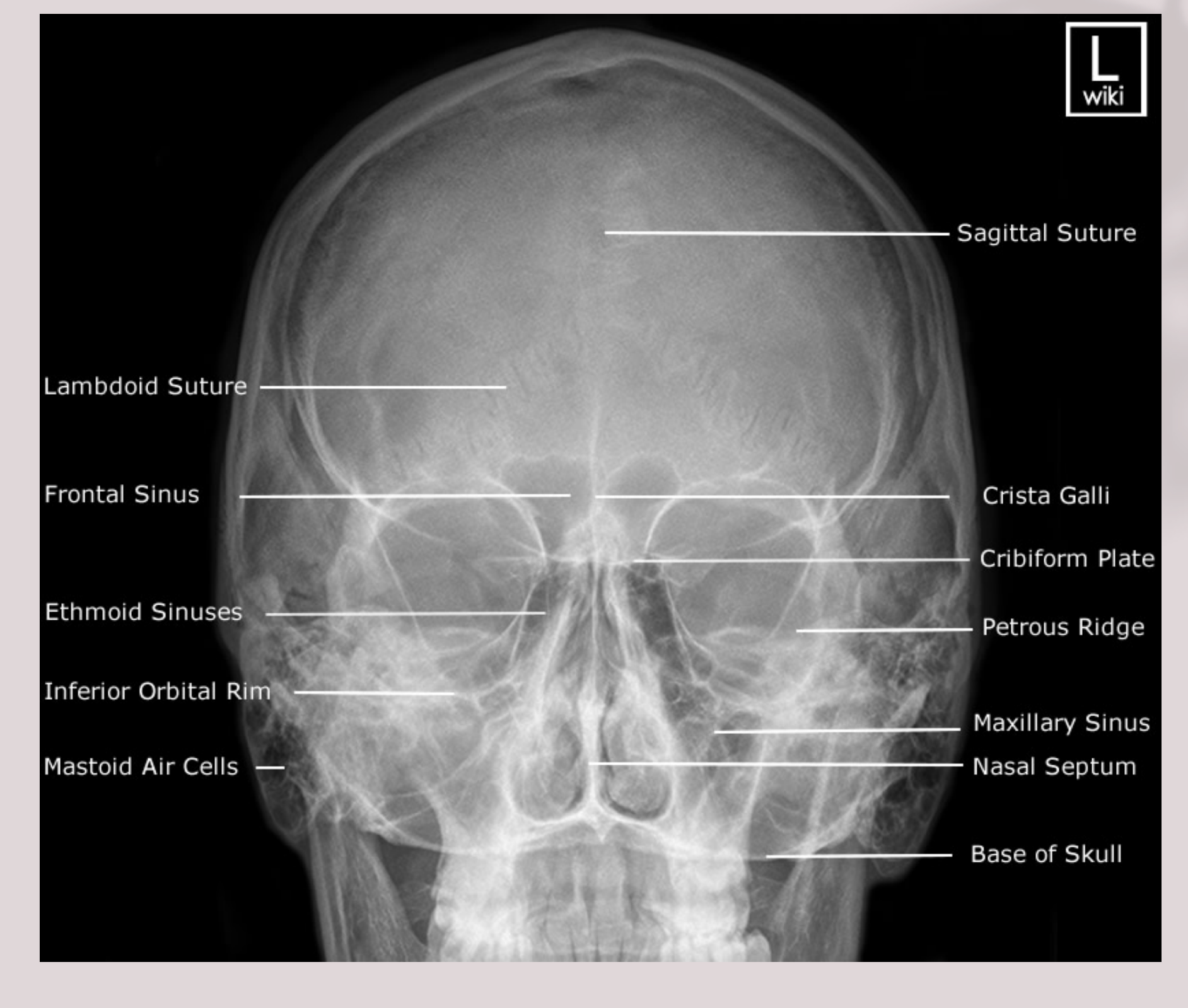 PA Skull