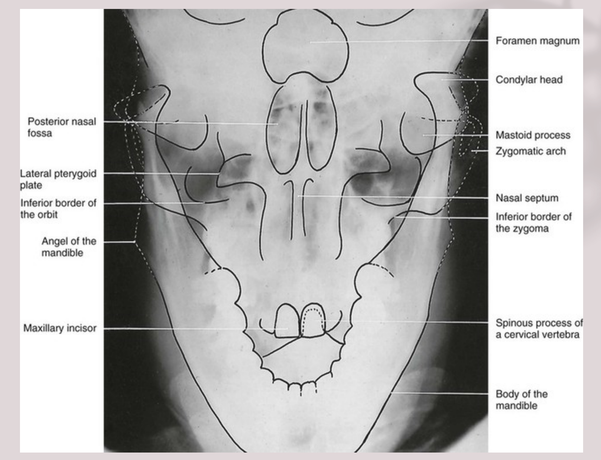 Reverse Towne Anatomy