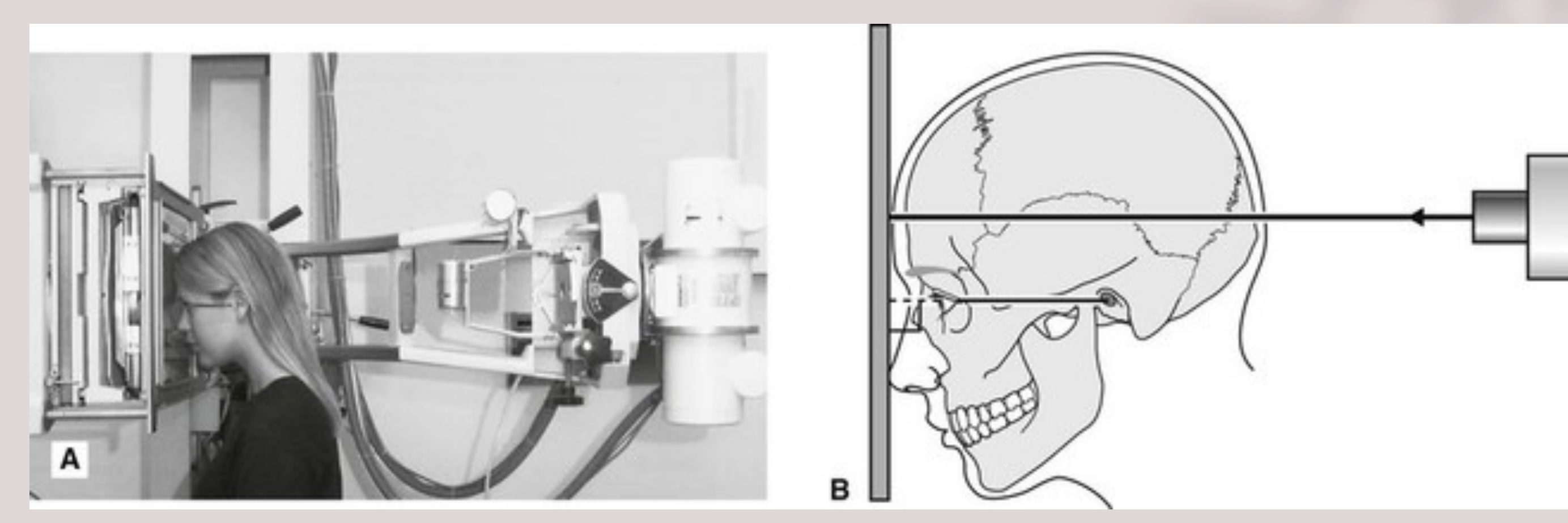 PA Skull