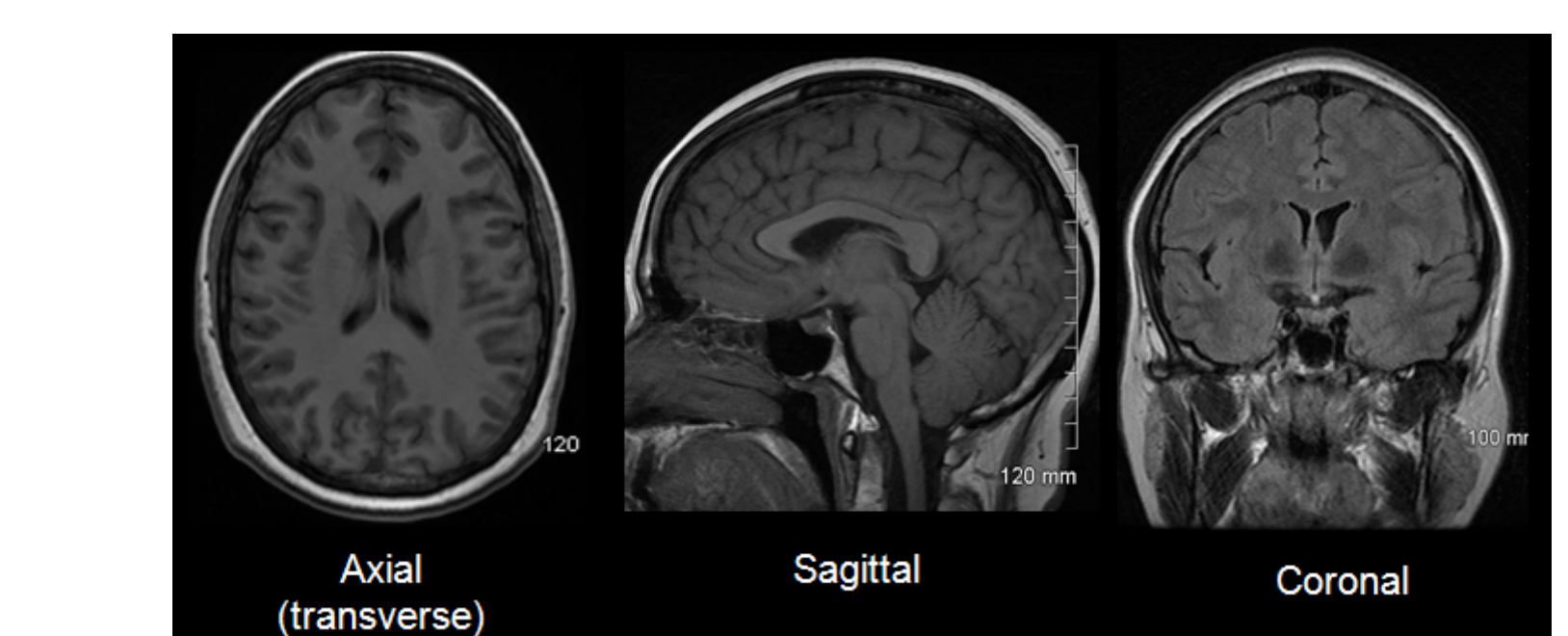 MRI images