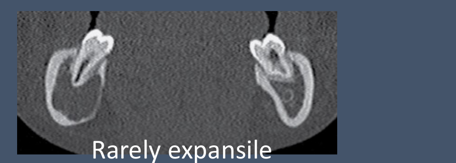 Rarely expansile